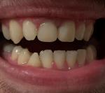 Вопрос гастроэнтерологу про зубы фото 2