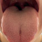 В норме ли язык? фото 1