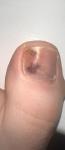 Безболезненные пятна на ногтях фото 2