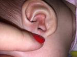 Разные дырочки в ушной раковине у ребенка фото 1