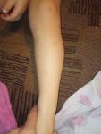 Синяки на ногах у ребенка 3 года фото 1