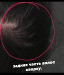 Очень редкие волосы на задней части головы фото 1