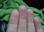 Морщины на подушечках пальцев фото 1