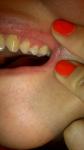Налет на зубах фото 2