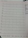 Нужна консультация кардиолога по моему ЭКГ фото 2