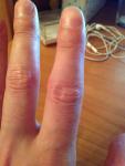 Больно сгибать указательный палец фото 2