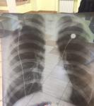 Рентген грудной клетки фото 1