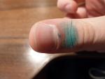 Царапина на пальце ниже ногтя фото 1