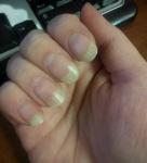 Белые полосы на ногтях, бледный цвет ногтей фото 2