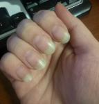 Белые полосы на ногтях, бледный цвет ногтей фото 3