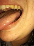 Оппух язык и болит фото 1