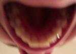 Кривые зубы фото 1