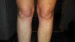 Болит правая нога от бедра до колена фото 3