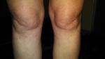Болит правая нога от бедра до колена фото 2