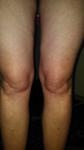Болит правая нога от бедра до колена фото 1