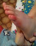 Красные подушечки пальцев на ногах фото 2