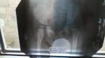 Дисплазия тазобедренных суставов, правильно ли сделан ренген снимок? фото 1