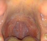 Болит горло слева и что то желтое фото 1