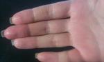 Сухость и трещины на подушечках пальцев одной руки фото 2
