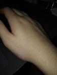 Сыпь на руках, появилась недавно, не знаю с чем связано фото 3