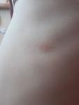 Бледно-розовое пятно у ребенка 3 лет фото 2