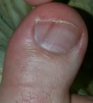 Полоска на ногте коричневого цвета фото 1