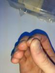 Проблемы с ногтевой пластиной фото 3