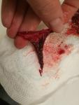 Задержка, сгустки в менструальной крови фото 2
