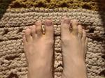Желтые пятна на пальцах ног и кистях рук фото 1
