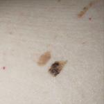 Тревога цвет родинки фото 1