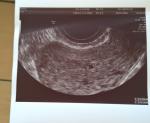 Беременность 3 недели фото 1