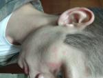 Шелушение пятнами на лице и в волосах фото 2