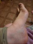 Беспокойство рук и ног фото 3