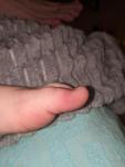 Кожное уплотнение на пальце ноги у ребенка фото 2
