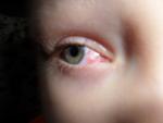 Ребенок получил травму в глаз веткой фото 1
