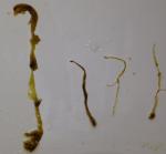 Аскориды после приема льняного семени фото 1