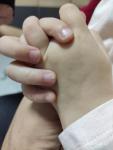 Изменение ногтевой пластины у ребенка фото 2