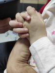Изменение ногтевой пластины у ребенка фото 1
