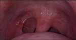 Полость рта, горло, панические атаки фото 1