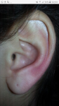 Красное ухо фото 1
