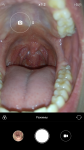 Острая боль в глубине горла, боль в мышцах рта фото 1