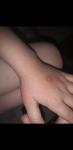 Красно шершавые пятна на руке у ребенка фото 2