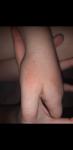 Красно шершавые пятна на руке у ребенка фото 3