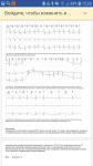 Мониторинг ЭКГ, как обстоят дела с сердцем фото 1