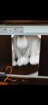 Рентген молочного зуба фото 2