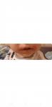Покраснение кожи вокруг рта у ребенка 1 год и 1 месяц фото 1