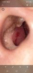Кровь из носа после промывания фото 1