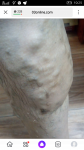 Вены на ногах и лечение фото 1