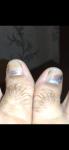 Темные пятна на ногтях ног фото 1