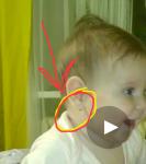 Прокол мочки уха, где при рождении была геонгеома фото 1